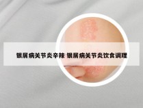 银屑病关节炎辛辣 银屑病关节炎饮食调理