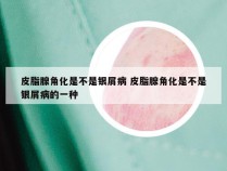 皮脂腺角化是不是银屑病 皮脂腺角化是不是银屑病的一种