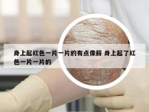身上起红色一片一片的有点像藓 身上起了红色一片一片的