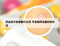 药浴去牛皮癣都什么药 牛皮癣药浴最好的办法
