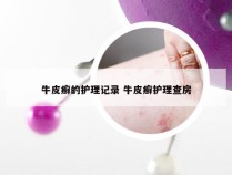 牛皮癣的护理记录 牛皮癣护理查房