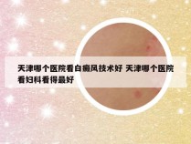 天津哪个医院看白癜风技术好 天津哪个医院看妇科看得最好