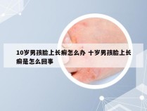 10岁男孩脸上长癣怎么办 十岁男孩脸上长癣是怎么回事