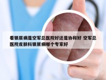 看银屑病是空军总医院好还是协和好 空军总医院皮肤科银屑病哪个专家好