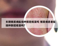 长期银屑病能接种新冠疫苗吗 银屑病患者能接种新冠疫苗吗?