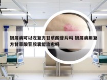 银屑病可以吃复方甘草酸苷片吗 银屑病用复方甘草酸苷胶囊能治愈吗