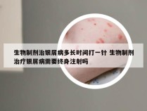 生物制剂治银屑病多长时间打一针 生物制剂治疗银屑病需要终身注射吗