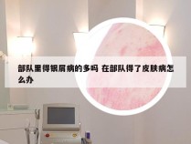 部队里得银屑病的多吗 在部队得了皮肤病怎么办