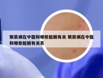 银屑病在中医和哪些脏腑有关 银屑病在中医和哪些脏腑有关系