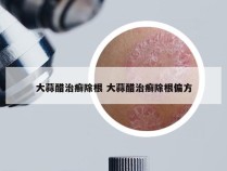 大蒜醋治癣除根 大蒜醋治癣除根偏方
