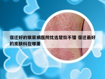 宿迁好的银屑病医院优选楚街不错 宿迁最好的皮肤科在哪里