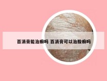 百消膏能治癣吗 百消膏可以治股癣吗