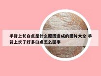 手背上长白点是什么原因造成的图片大全 手背上长了好多白点怎么回事