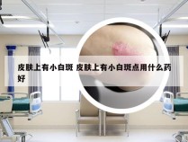皮肤上有小白斑 皮肤上有小白斑点用什么药好