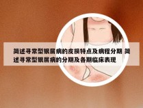 简述寻常型银屑病的皮损特点及病程分期 简述寻常型银屑病的分期及各期临床表现