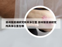 郑州银屑病研究所具体位置 郑州银屑病研究所具体位置在哪