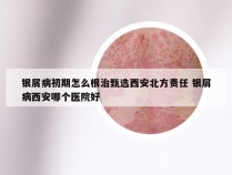 银屑病初期怎么根治甄选西安北方责任 银屑病西安哪个医院好