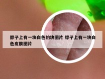脖子上有一块白色的块图片 脖子上有一块白色皮肤图片