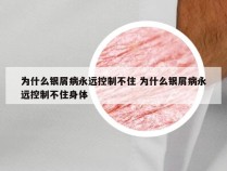 为什么银屑病永远控制不住 为什么银屑病永远控制不住身体