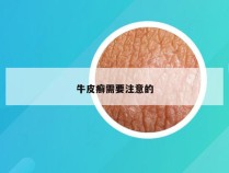 牛皮癣需要注意的