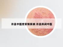 许昌中医世家银屑病 许昌民间中医