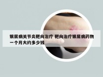 银屑病关节炎靶向治疗 靶向治疗银屑病药物一个月大约多少钱