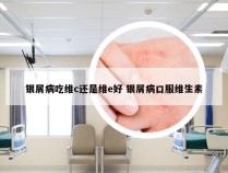 银屑病吃维c还是维e好 银屑病口服维生素