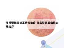 寻常型银屑病系统性治疗 寻常型银屑病稳定期治疗