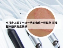 小孩身上起了一块一块的像癣一样红色 百度扫一扫识别皮肤病