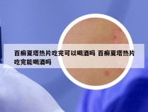百癣夏塔热片吃完可以喝酒吗 百癣夏塔热片吃完能喝酒吗