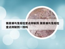 银屑病与免疫检查点抑制剂 银屑病与免疫检查点抑制剂一样吗