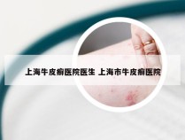 上海牛皮癣医院医生 上海市牛皮癣医院
