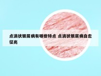 点滴状银屑病有哪些特点 点滴状银屑病自愈征兆