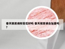 春天银屑病和菊花好吗 春天银屑病会加重吗?
