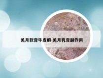 羌月软膏牛皮癣 羌月乳膏副作用