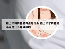脸上长得白色的白点是什么 脸上长了白色的小点是什么导致成的