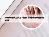 泰安银屑病孟晨星A首去 泰安银屑病医院好不好