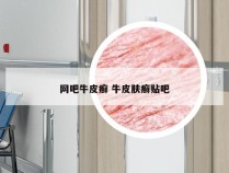 网吧牛皮癣 牛皮肤癣贴吧