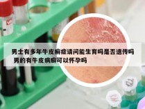 男士有多年牛皮癣症请问能生育吗是否遗传吗 男的有牛皮病癣可以怀孕吗
