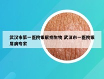 武汉市第一医院银屑病生物 武汉市一医院银屑病专家