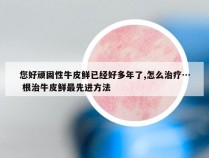 您好顽固性牛皮鲜已经好多年了,怎么治疗… 根治牛皮鲜最先进方法