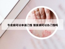 牛皮癣可以申请门慢 银屑病可以办门慢吗