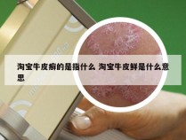 淘宝牛皮癣的是指什么 淘宝牛皮鲜是什么意思