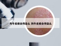 狗牛皮癣会传染么 狗牛皮癣会传染么