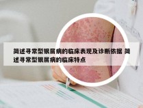 简述寻常型银屑病的临床表现及诊断依据 简述寻常型银屑病的临床特点