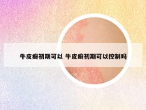 牛皮癣初期可以 牛皮癣初期可以控制吗