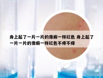 身上起了一片一片的像癣一样红色 身上起了一片一片的像癣一样红色不疼不痒