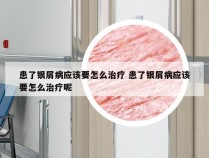 患了银屑病应该要怎么治疗 患了银屑病应该要怎么治疗呢