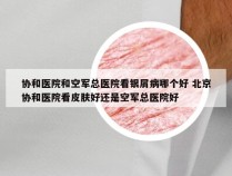 协和医院和空军总医院看银屑病哪个好 北京协和医院看皮肤好还是空军总医院好