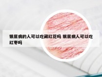 银屑病的人可以吃藏红花吗 银屑病人可以吃红枣吗